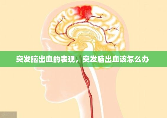 突发脑出血的表现，突发脑出血该怎么办 