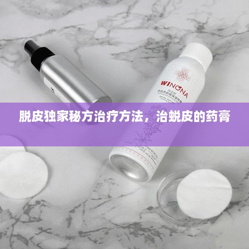 脱皮独家秘方治疗方法，治蜕皮的药膏 