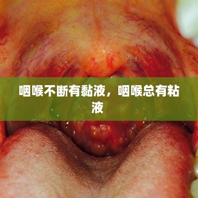 咽喉不断有黏液，咽喉总有粘液 