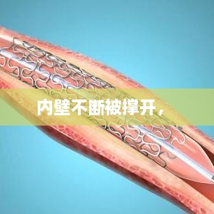 内壁不断被撑开， 