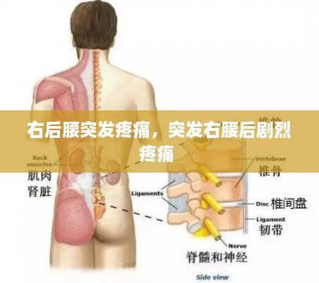 右后腰突发疼痛，突发右腰后剧烈疼痛 