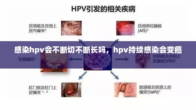 感染hpv会不断切不断长吗，hpv持续感染会变癌 