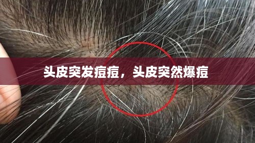 头皮突发痘痘，头皮突然爆痘 